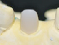 ファイバーコア