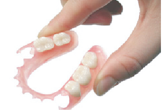 フレキシブルデンチャー