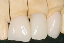 プロビジョナル